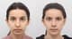 Slider image (6) AB Plastic Surgery
